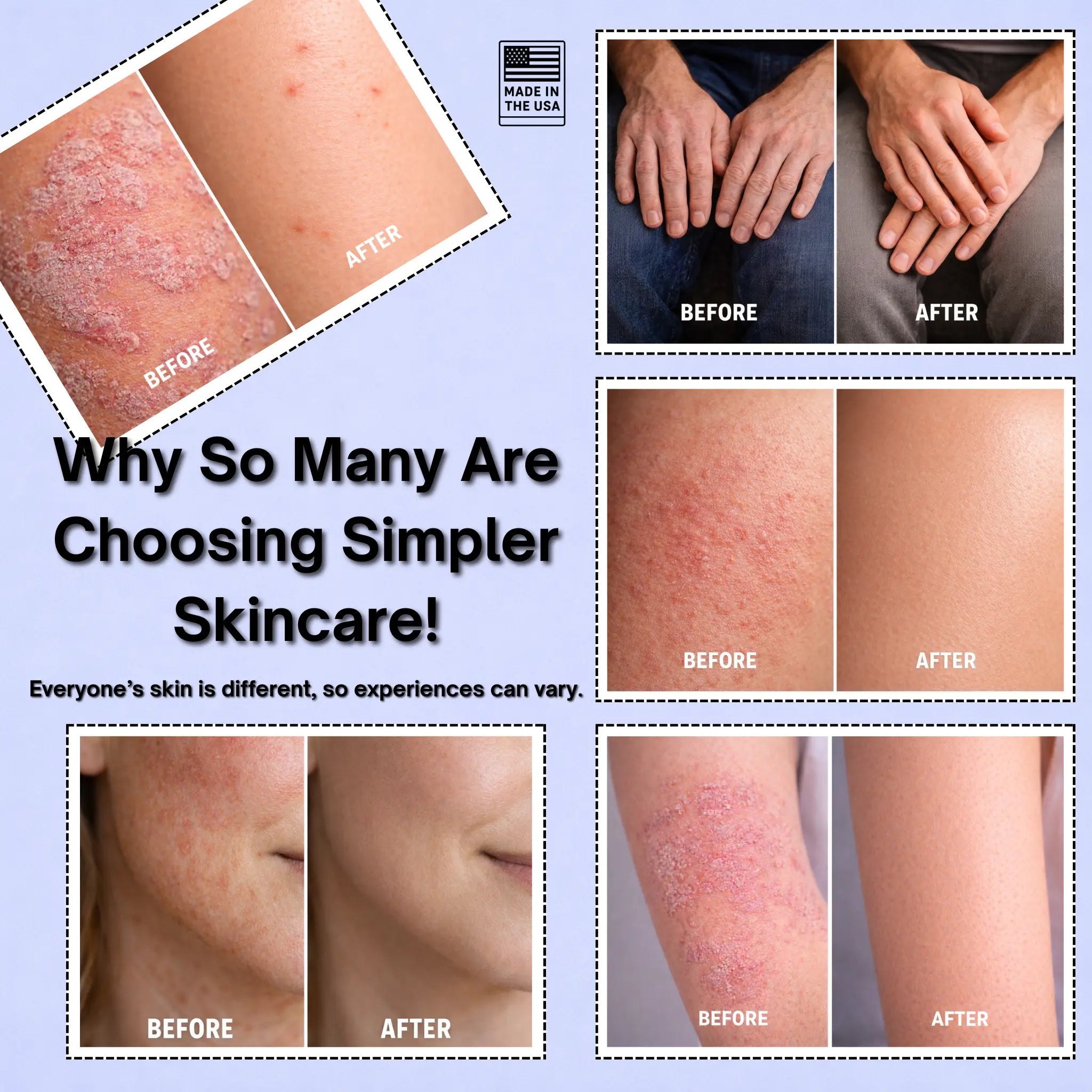 Luxurious Pure Whipped Tallow Cream for Ultimate Skin Hydration